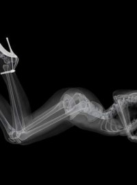 x ray nude